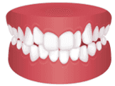 /static/55e39b78be776de392e77f6031293b76/4a2d5/alignerbase-home-service-img-1.png