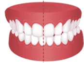 /static/b2bfa3e8c7c8525f2a0f4d8b2375a7f7/1aed2/alignerbase-home-service-img-7.png